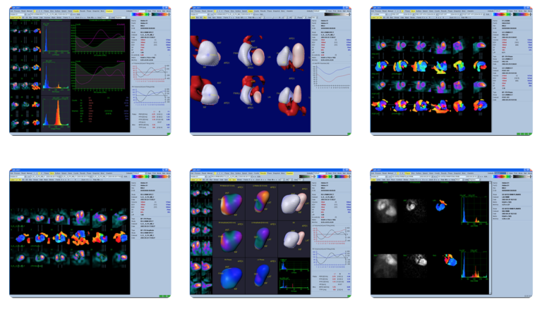 Cedars-Sinai Research Recognized at SCCT 2020