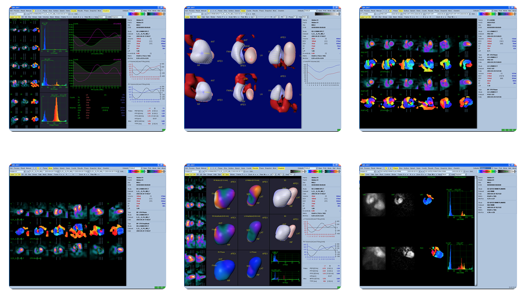 You are currently viewing Cedars-Sinai Research Recognized at SNMMI 2020