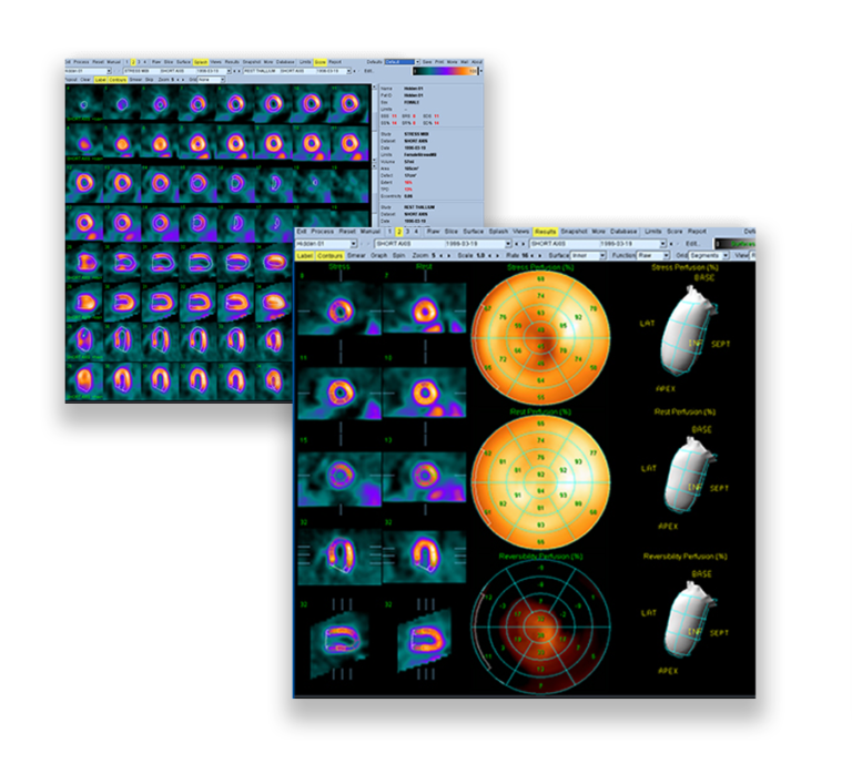 quad QUAD CedarsSinai
