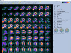 Splash page with ammonia study showing automatic LV coverage