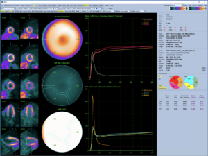 Kinetic page with dynamic ammonia study