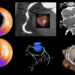 Advances in Nuclear Cardiology, Cardiac CT and Cardiac MRI: 37th Annual Case Review with the Experts – Coming in January 2024