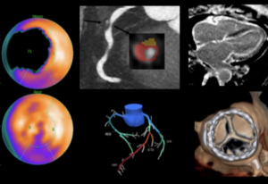 Read more about the article Advances in Nuclear Cardiology, Cardiac CT and Cardiac MRI: 36th Annual Case Review with the Experts – Coming in January 2023