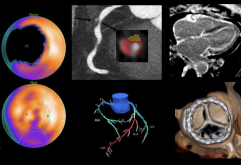 Advances in Nuclear Cardiology, Cardiac CT and Cardiac MRI: 37th Annual Case Review with the Experts – Coming in January 2024