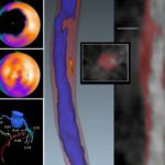 Advances in Nuclear Cardiology, Cardiac CT and Cardiac MRI: 38th Annual Case Review with the Experts – January 2026