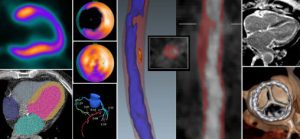 Read more about the article Advances in Nuclear Cardiology, Cardiac CT and Cardiac MRI: 38th Annual Case Review with the Experts – January 2026