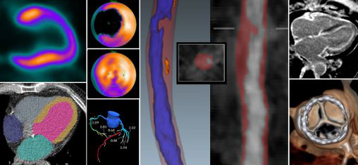 Advances in Nuclear Cardiology, Cardiac CT and Cardiac MRI: 38th Annual Case Review with the Experts – January 2026