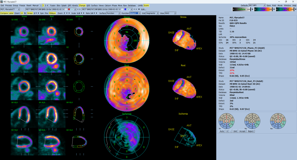 Flyrcado stress/rest voxel comparison in the Change page