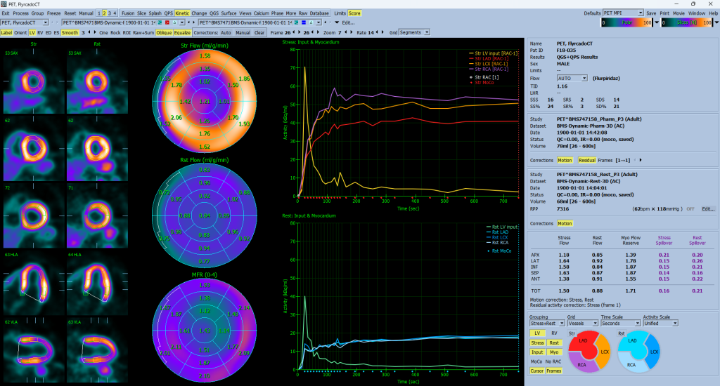 Dynamic Flyrcado stress/rest pair in the Kinetic page for myocardial blood flow analysis