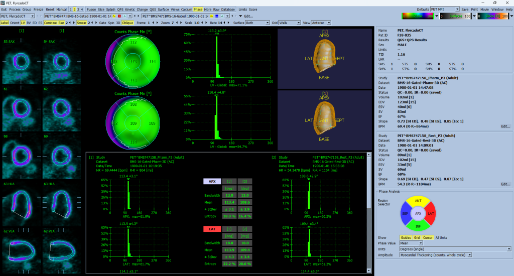 Flyrcado stress/rest gated pair in the Phase page