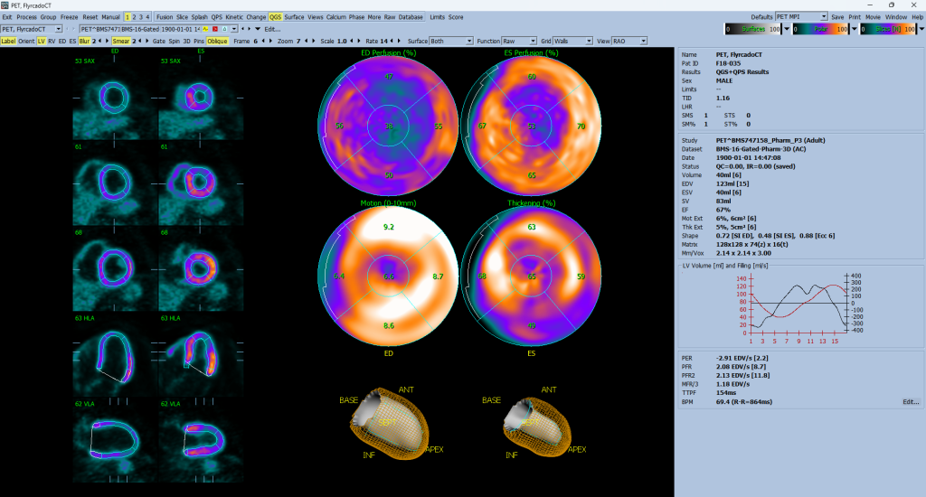 Flyrcado gated image in the QGS page